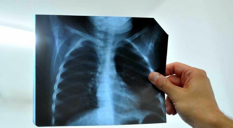 Detienen a radiólogo por abusar de un niño en Hospital de CDE: “No dejó entrar al padre”
