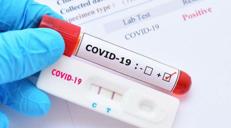 Reportan casi 150 nuevos casos de COVID-19 y un fallecido